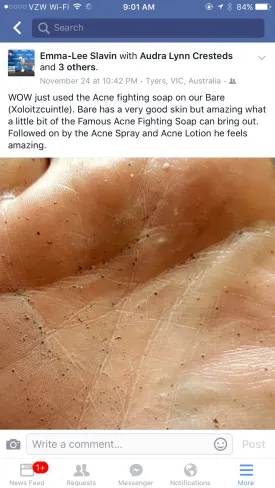 Famous Acne Fighting Soap